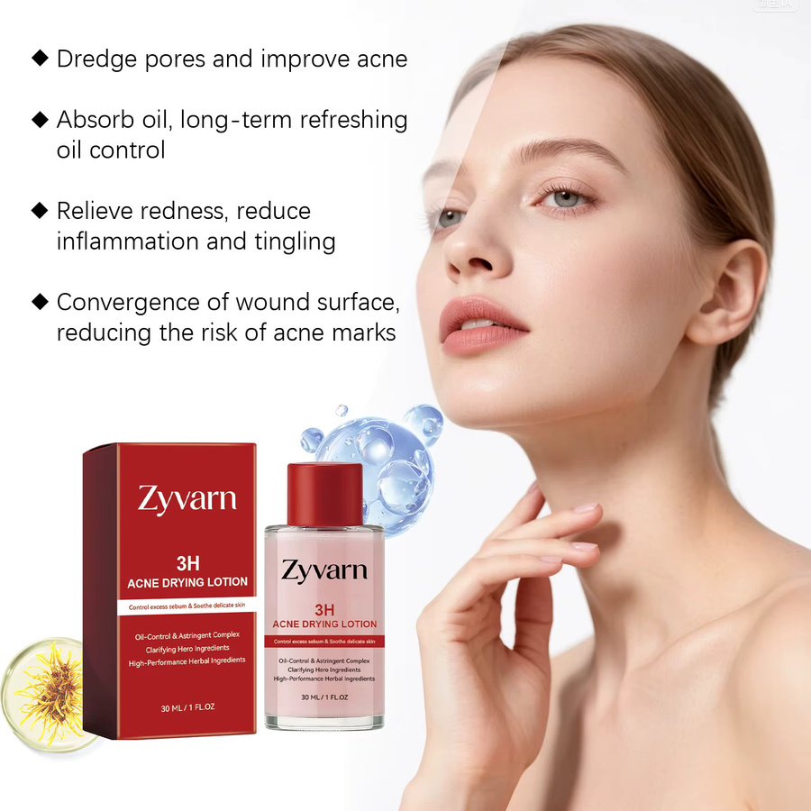 ZYVARN Akne-Reparatur Trocknungslotion, 30 ml, Unreine Haut - Bild 4