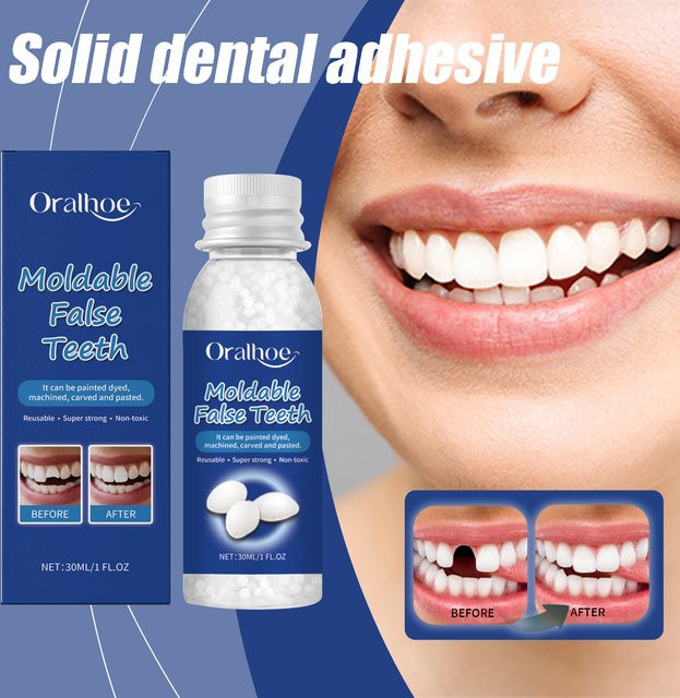 Oralhoe Zahnkleber zur temporären Zahnlückenfüllung, 30 ml - Bild 1