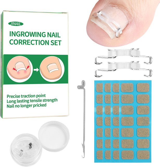 HNKMP Zehennagel Corrector Werkzeug, Unisex, für Füße - Bild 1