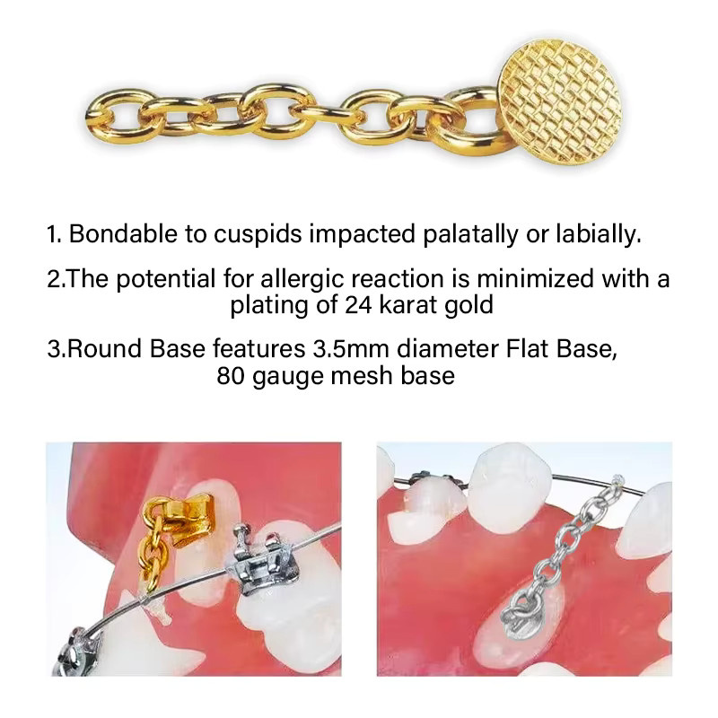 Agorth Kieferorthopädische Traktion Tasten, 10 Stück, Gold/Silber - Bild 1