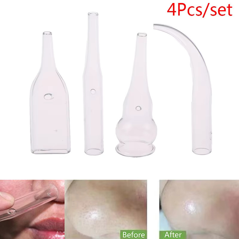 KuZHEN Vakuum-Extraktion Set zur Mitesser-Entfernung, 4 Teile, Unisex - Bild 3