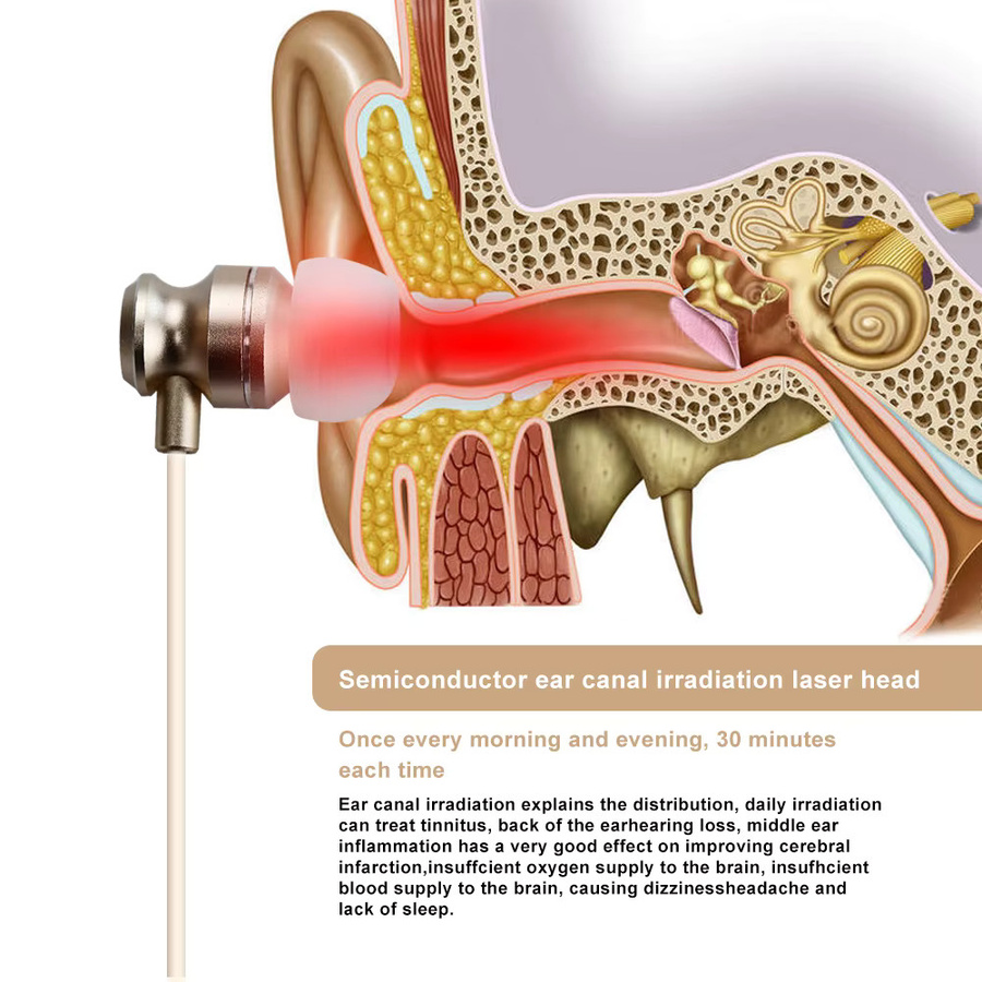 SANPKON Rotlicht-Lasertherapie LLLT zur Tinnitus- und Otitis Media Behandlung - Bild 4