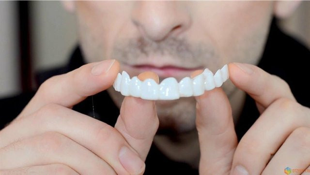 Pop Dental Snap Smile Zahnprothesen für den Oberen Kiefer, Flexible Veneers - Bild 1