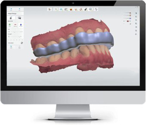 Exocad Smile Design Dentalsoftware Full Version mit Dongle für numerische Steuerung - Bild 1