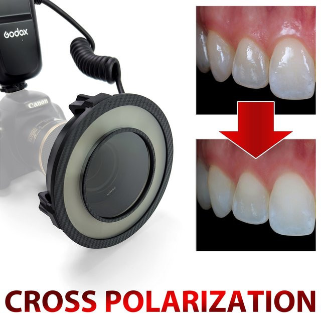 Godox MF-R76 Polar Eye Cross-Polarisation für Dental-Kamera-Blitze in Schwarz - Bild 1