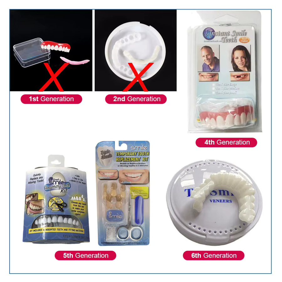 Oralhoe Temporäre Ober- und Unterkiefer-Veneers, flexible Schnappklammern - Bild 2