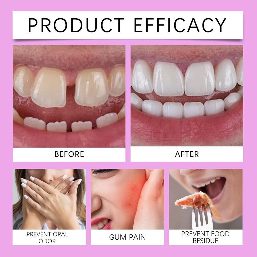 Oralhoe Thermoplastischer Prothesenkleber zur Zahnprothesenpflege - Bild 5