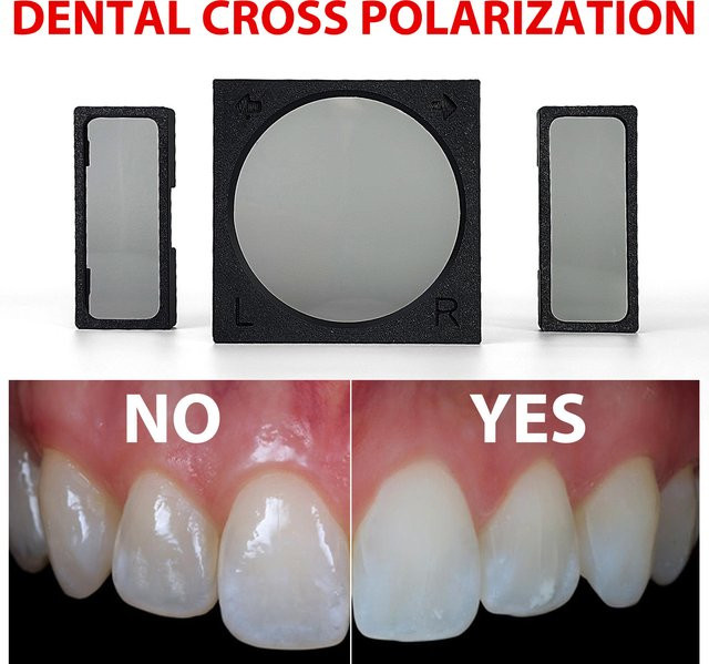RemenHera Dental Cross Polarisierender Kameraobjektivfilter in Schwarz für die orale Fotografie zur Vermeidung von Blendung und Reflexionen - Bild 1
