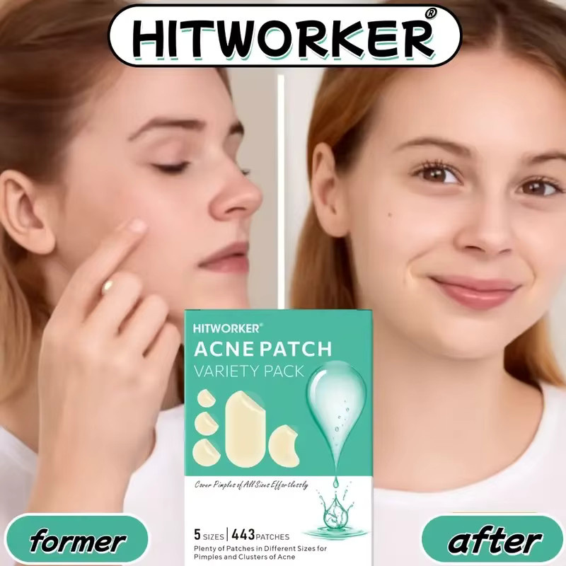 HITWORKER Gesichts-Aknepflaster, Hellbeige, 443 Stück, Unisex - Bild 2