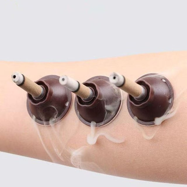 PAQIN Moxa Stick Moxibustion Aufkleber, 50 Stück - Bild 1