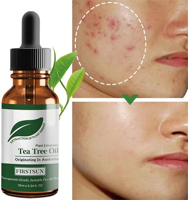 CD Teebaumöl Feuchtigkeitscreme, 5 ml, mit Niacinamid, Damen - Bild 1
