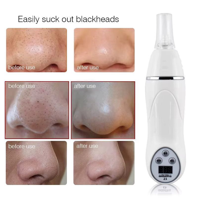 Raiuleko Diamant Dermabrasion Gesichtsvakuum, Unreine Haut / Akne, Unisex - Bild 2
