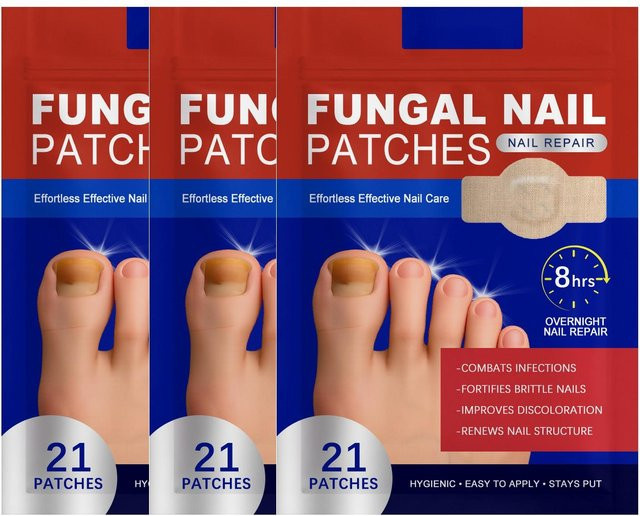 Xingben Ten Pilz-Nagelpflaster, 21 Stück, Unisex - Bild 1