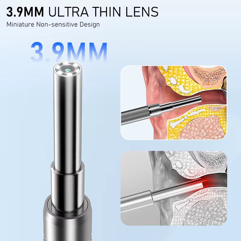 ZYPUSON Digitales Otoskop mit 7-Zoll-Bildschirm, Unisex - Bild 3