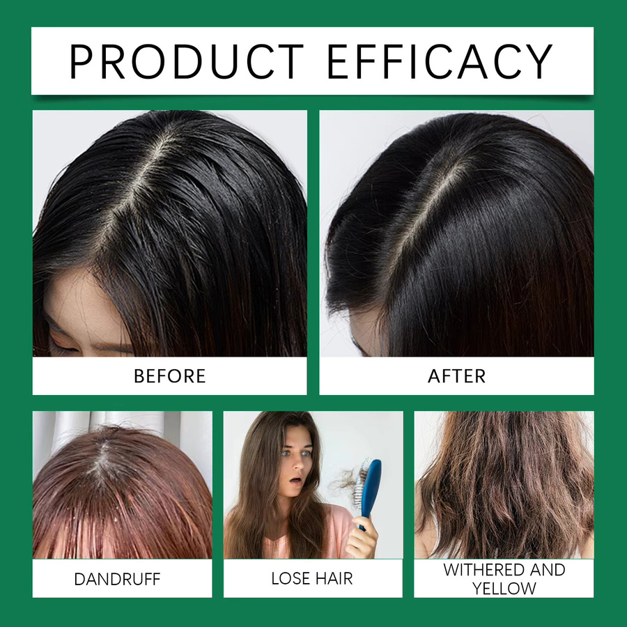 eelhoe Teebaum Shampoo und Spülung Haarpflege-Set - Bild 5