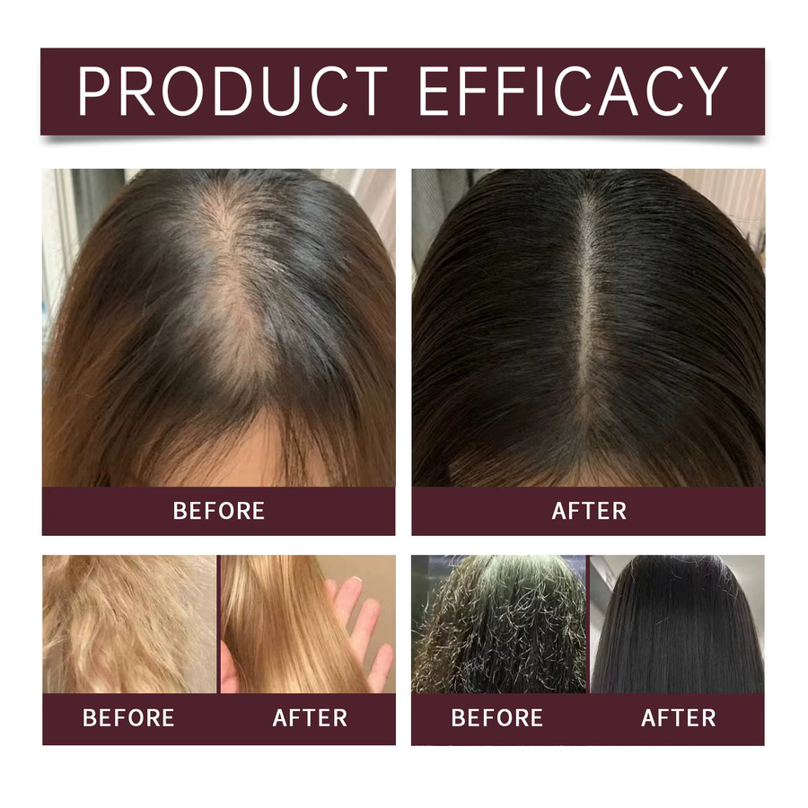 HOEGOA Bio-Batana Haarshampoo mit Öl, Kopfhaut und Haare - Bild 5