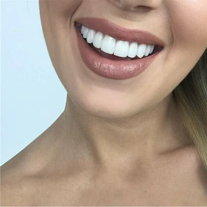 Pop Dental Snap Smile Zahnprothesen für den Oberen Kiefer, Flexible Veneers - Bild 5