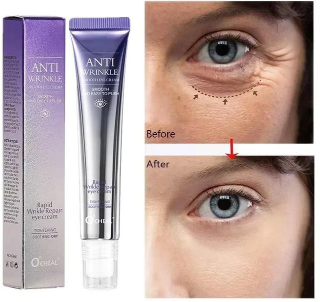 Perfect Skin Augencreme mit Retinol und Hyaluronsäure, Unisex - Bild 1