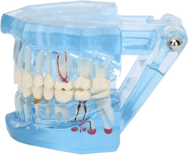 GoolRC Dental Zähne Modell, Acryl, Blau Transparent, Demonstration Simulation Zähne Modell white - Bild 1