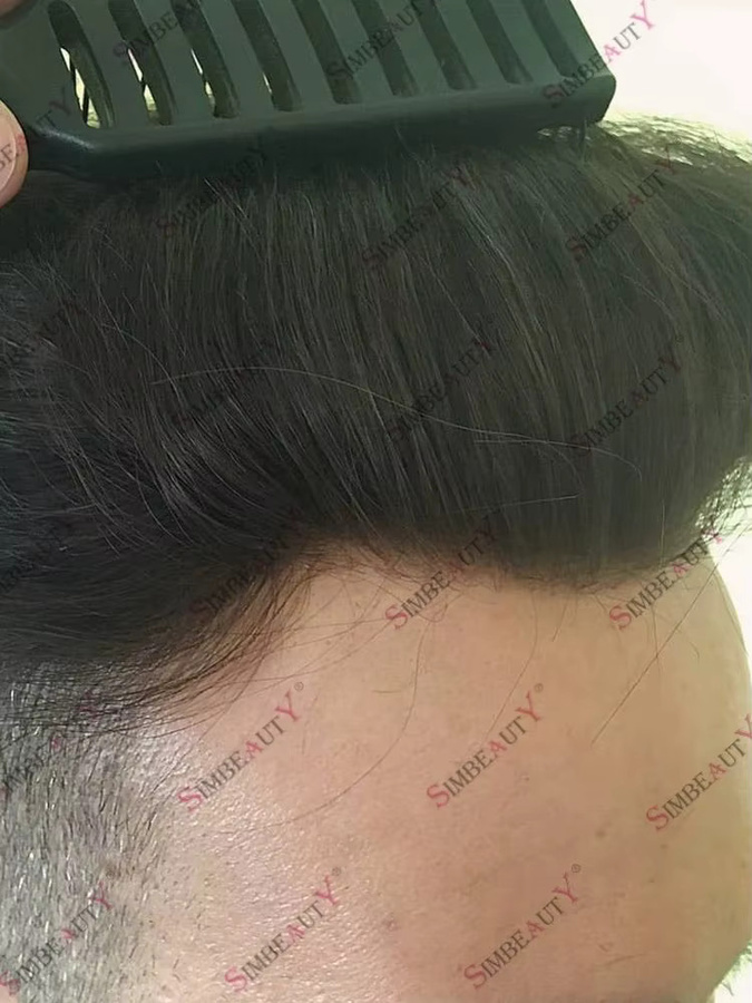 simbeauty Echthaar-Toupet Wellenförmig, Silikon-Vollhautbasis, Herren - Bild 3