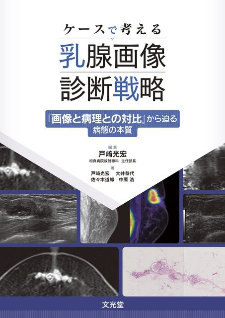 Diagnostische Strategien in der Brustbildgebung basierend auf Fallstudien von 戸崎光宏, 大井恭照, 佐々木道郎, 中原 浩, Sachbuch - Bild 1