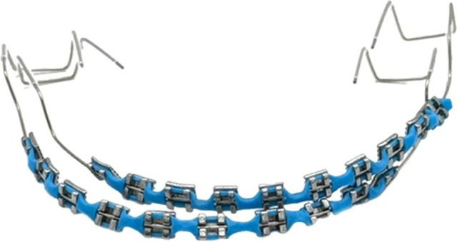 Binchi Health Electronics Zahndekor Zubehör, Bunte Brackets, Hellblau - Bild 1