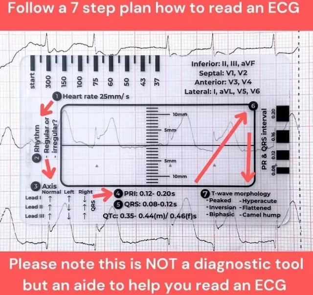 Tragbares EKG 7-Stufen-Lineal aus transparentem Kunststoff für die professionelle EKG-Beobachtung und Interpretation - Bild 1