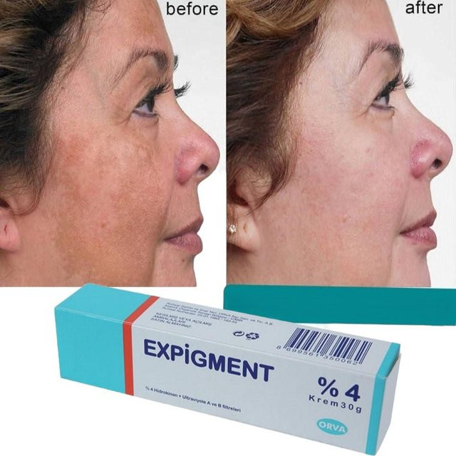 Expigment Hautaufhellende Creme, Unisex - Bild 1