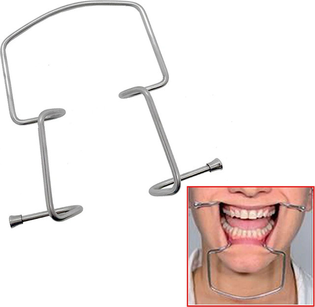 Muduoban Mundretraktor aus Edelstahl, Intraoraler Expander - Bild 1