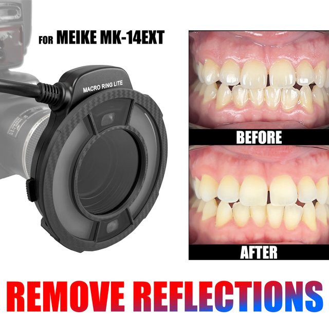 MEIKE CPL Polarisationsfilter für MK-14EXT Blitzring in Schwarz zur Reduzierung von Reflexionen und Blendungen in der Zahnfotografie - Bild 1