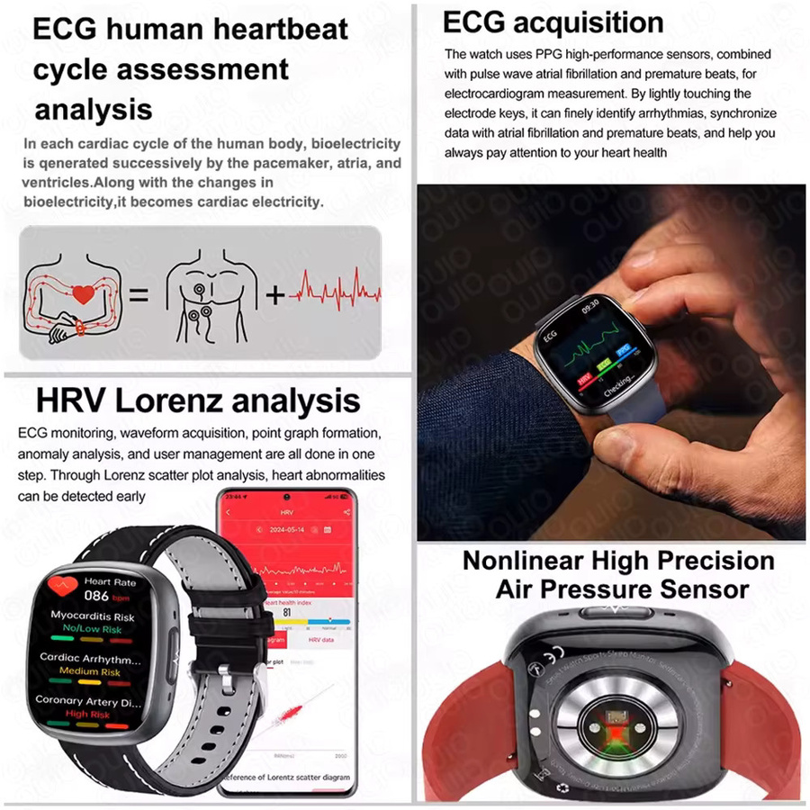 OUIO NFC Gesundheitsmonitor Smartwatch in Schwarz mit EKG, PPG, Blutsauerstoff-, Blutdruck- und Harnsäure-Messung sowie Körperanalyse für Damen und Herren - Bild 5