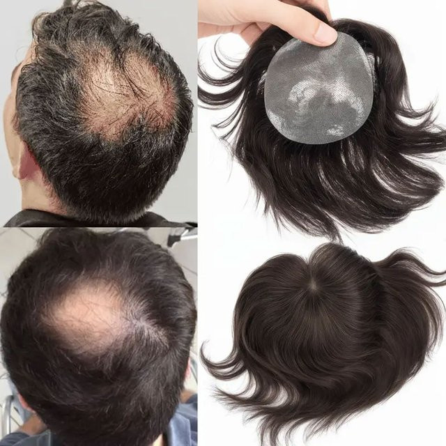 s-noilite Haar Patch Toupet für Männer, 100 % Remy Echthaar, PU - Bild 1