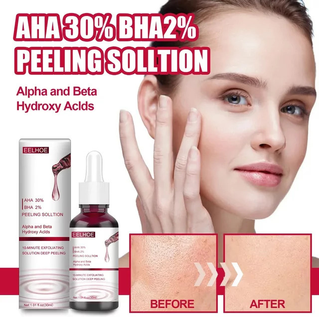 YOUNGCOME Serum, 30 ml, Salicylsäure, Unisex - Bild 1