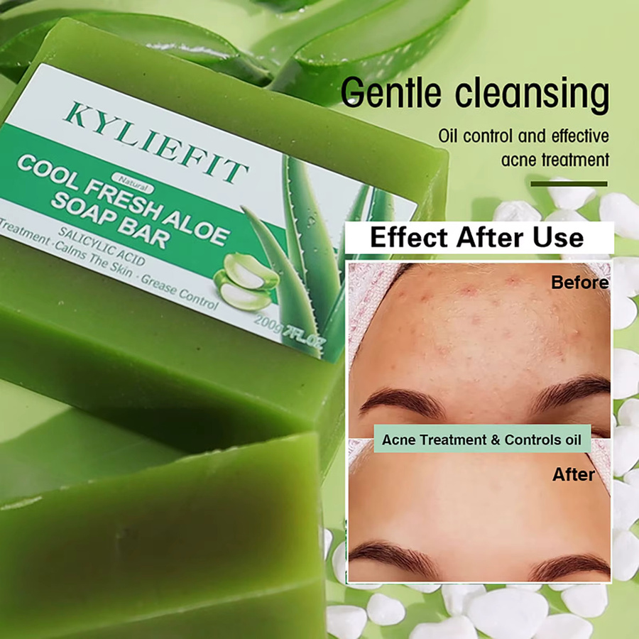 AILKE Aloe Brightening Soap Bar mit Aloe Vera, 200 g, Gesicht und Körper - Bild 4