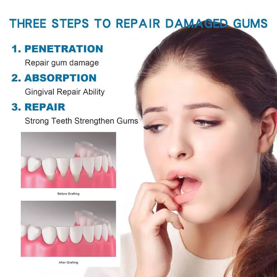 Oralhoe Zahnfleisch-Reparaturserum, Zahnreinigungstropfen - Bild 2