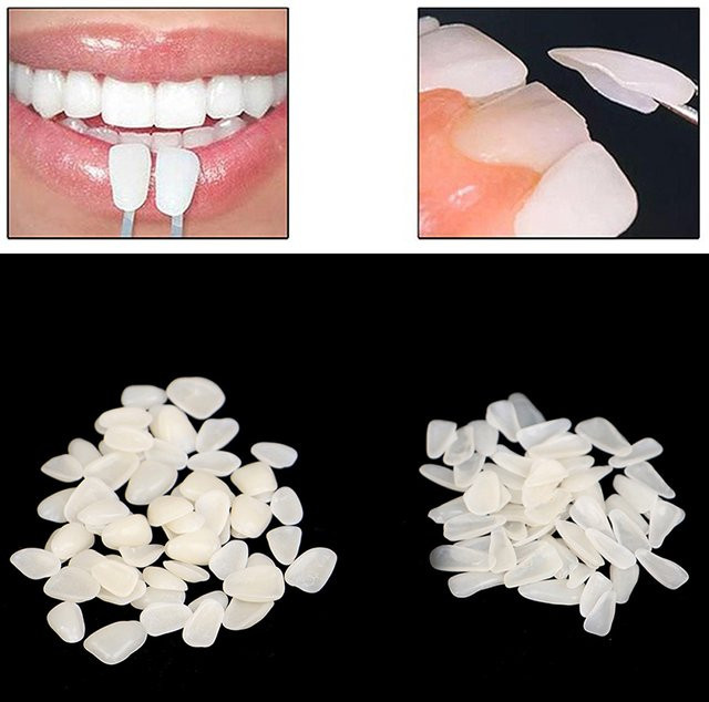 60 Stück White ning Veneers, temporäre Zähne aus Harz und Porzellan, ohne Kleber - Bild 1