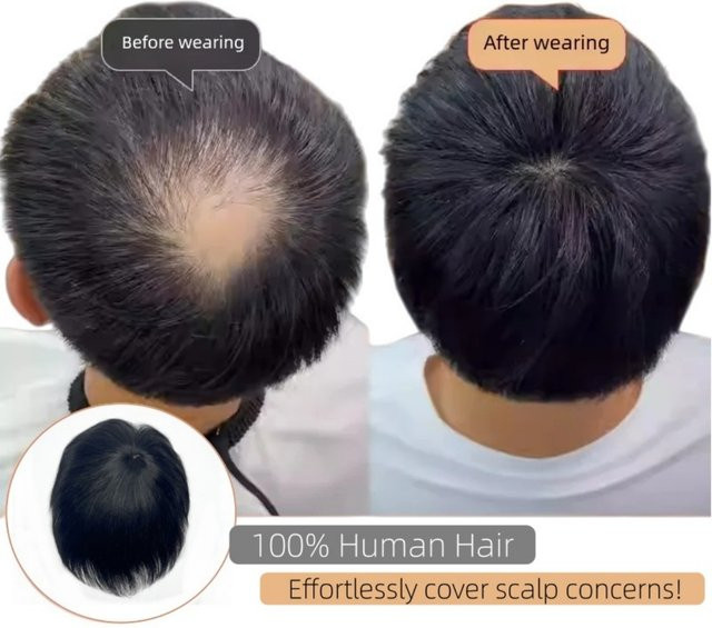 Anemone Toupet für Herren, schwarzes Echthaar-Topper, Clip-in - Bild 1