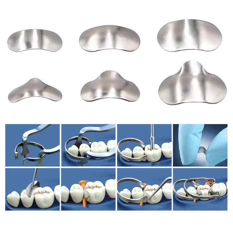 JIECARE Dental Douban Forming Sheet Set, Mundpositionierungs-Forming Sheet aus Edelstahl, mit zwei Ringen - Bild 2