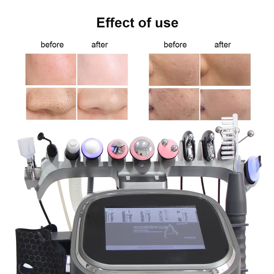 YUET WIN 12-in-1 Aqua-Peeling-Lifting-Gerät, Gesicht, Unisex - Bild 2