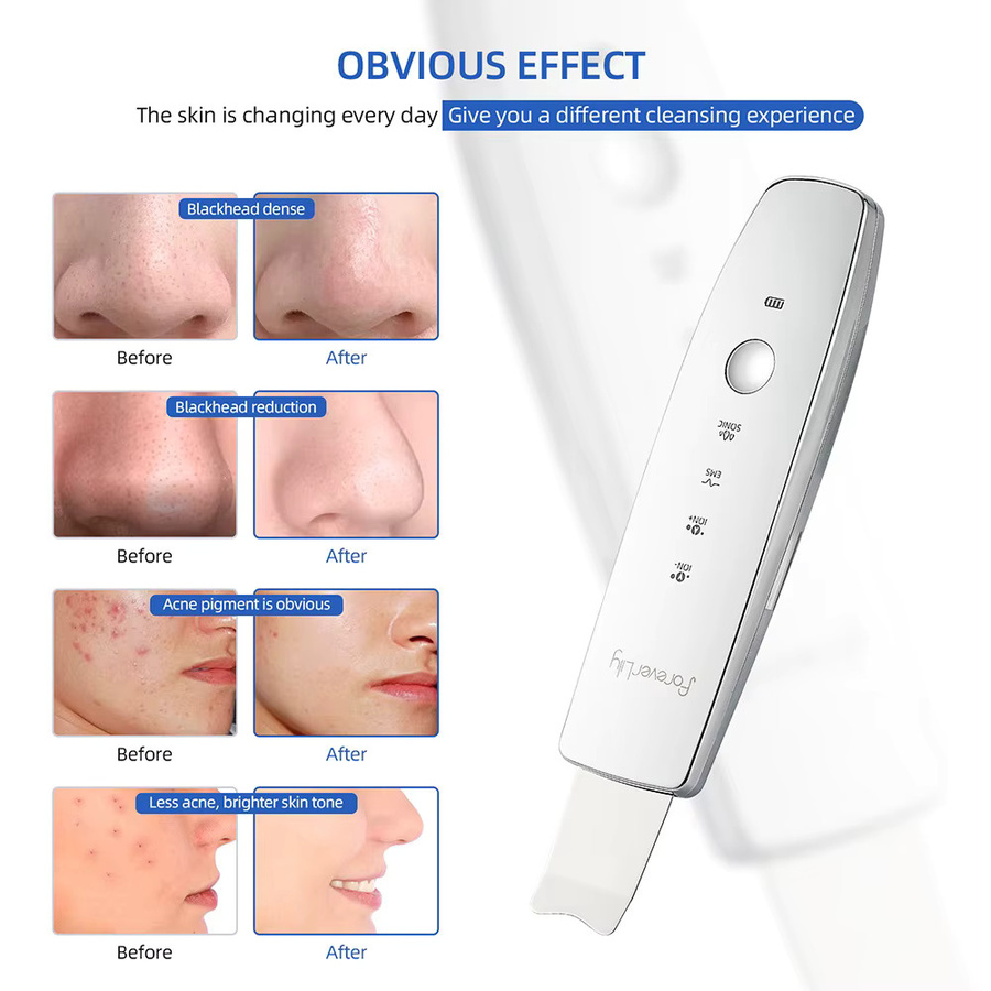 foreverlily 6-in-1 EMS Ultraschall-Hautwäscher Massagegerät, Unisex - Bild 4