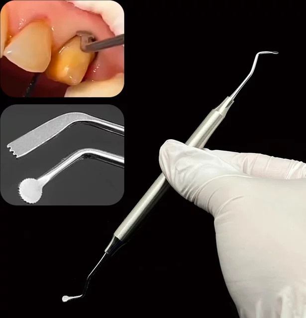 DENTOSEE Dental Scaler Doppel Enden, Edelstahl, Zahnfleisch Separator - Bild 1