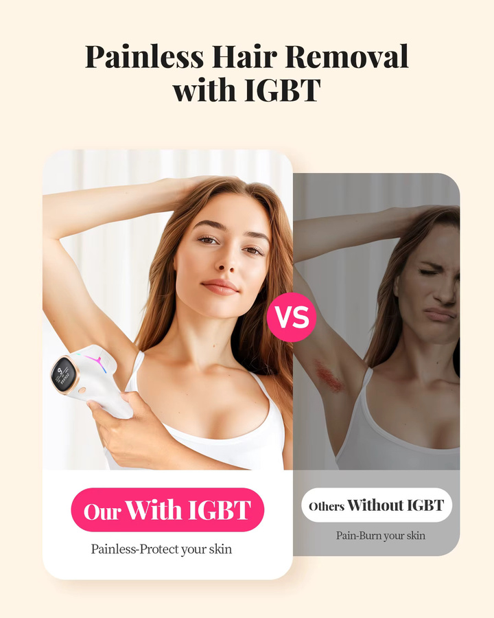 Totmizby IPL-Haarentfernungsgerät, 990.000 Flash, Weiß, Unisex - Bild 2