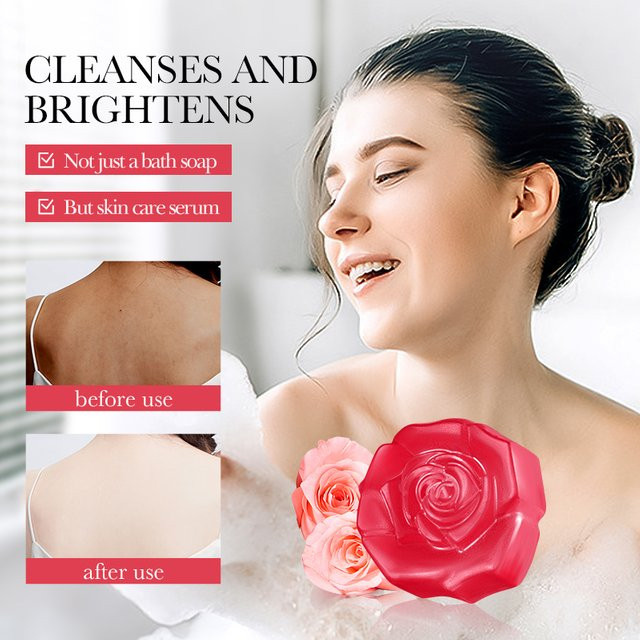 SADOER Rose Gesichtsreinigungsschaum, Unreine Haut / Akne, Gesicht & Körper - Bild 1