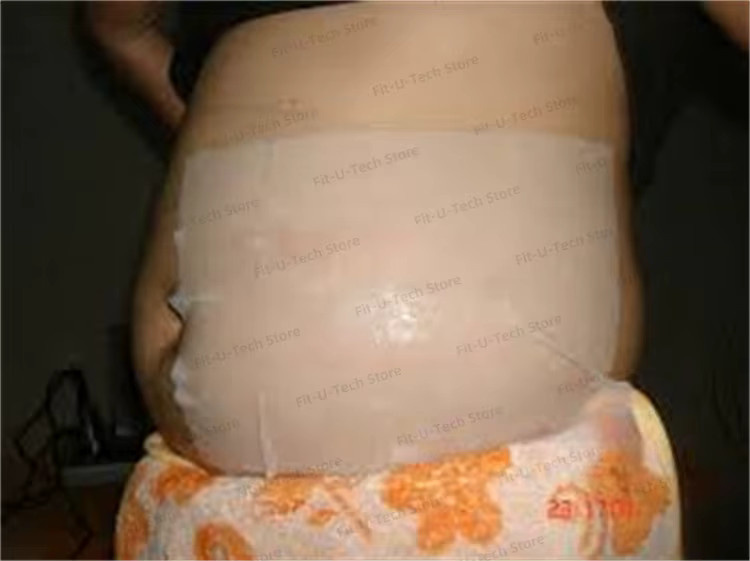 Körperformungs-Massagegerät zur Cellulite-Reduktion, Unisex - Bild 4