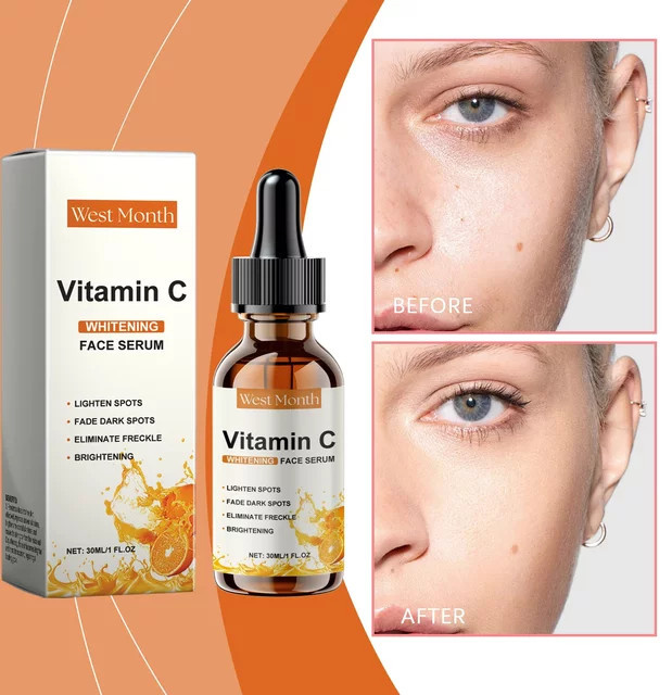 West Month Vitamin C Gesichtsserum - Bild 1