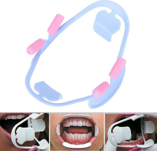 enjoysmile Lip Retractor, Mundöffner für Kieferorthopädie und Zahnmedizin - Bild 1