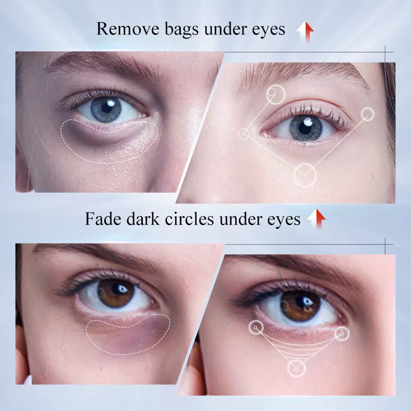 SADOER Augencreme mit Kojisäure und Retinol - Bild 2