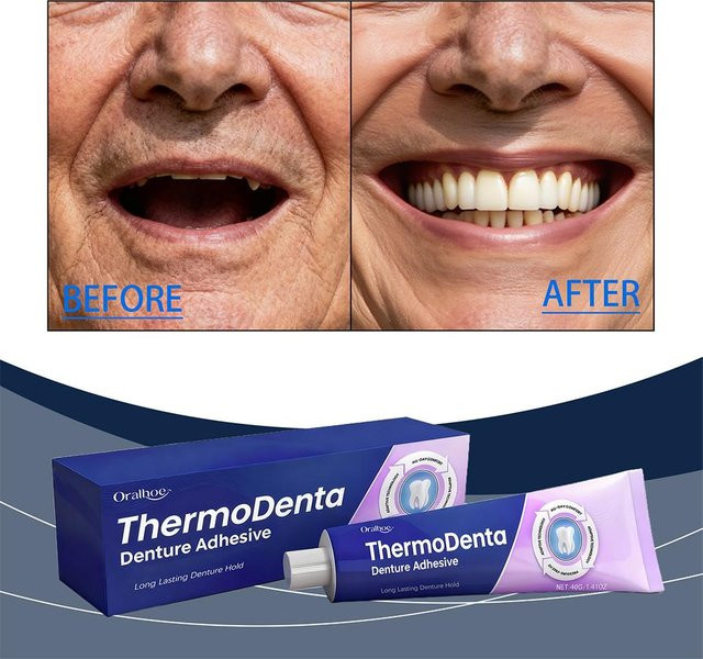 Oralhoe Zahnfixierkleber, Thermoplastischer Prothesenkleber - Bild 1