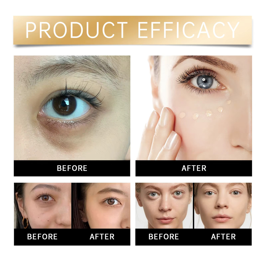 eelhoe Dark Circle Concealer Essence Cream, Augen-Make-up-Basis, Unisex - Bild 3