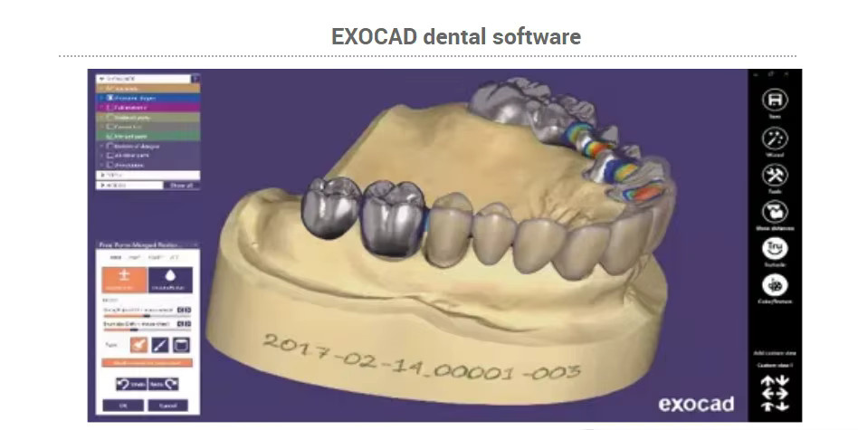 Exocad Smile Design Dentalsoftware Full Version mit Dongle für numerische Steuerung - Bild 2